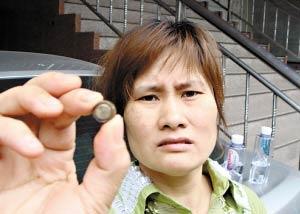 六岁女童下体被塞入电池