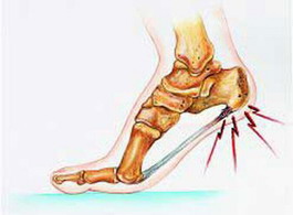 脚后跟疼_手脚保健