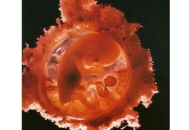 产生畸形儿的3大主要原因_畸形儿_孕妇疾病