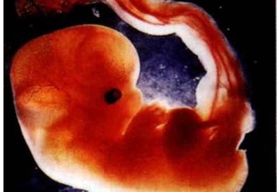 怀孕1个月:胎儿只是一个胚胎_胎儿发育