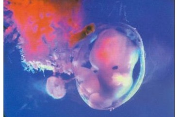 胎儿发育迟缓要怎么办_胎儿发育_亲亲宝贝网