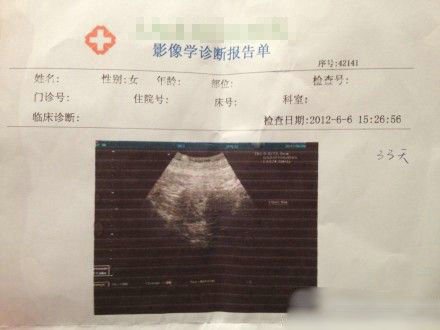 Gl小说 长篇的