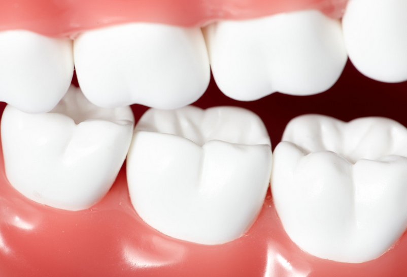 缓解牙齿过敏的4个技巧_百科知识