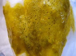 宝宝大便有泡沫了怎么办
