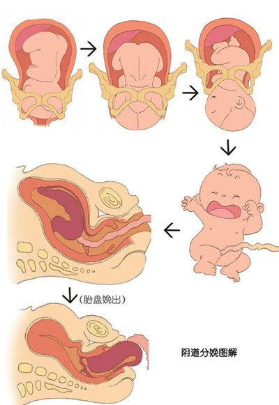 分娩产程