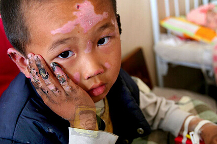 人和动物生的孩子