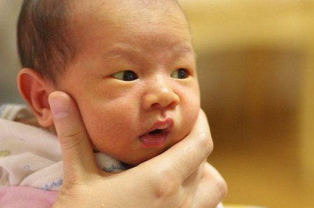黄疸高对婴儿有什么影响