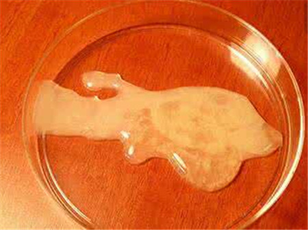精子不液化是什么原因造成的 导致精液不液化的6大罪魁祸首
