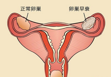 保养卵巢，这4个方面要注意了！