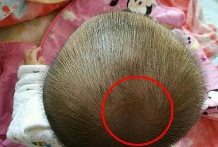 宝宝头上的旋代表什么含义? 一个旋和多个旋宝宝的性格很不同？