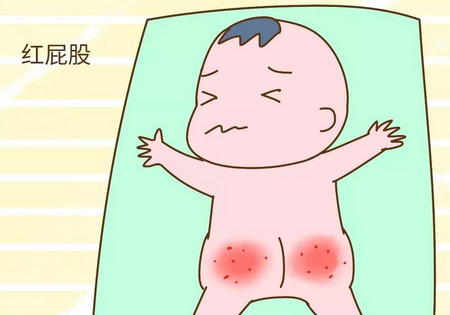 宝宝红屁股别大意！这几条挑选纸尿裤的指标要注意了