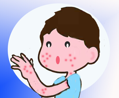 宝宝湿疹严重怎么办，宝宝有湿疹怎么办